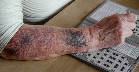 Śląsk: Przybywa stulatków. Najstarsza z osób ma 108 lat