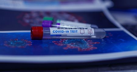 Koronawirus. Słowacja masowo testuje obywateli. Wykonano miliony badań