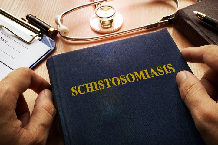 Schistosomatoza (bilharcjoza) to choroba pasożytnicza popularna w klimacie tropikalnym.
