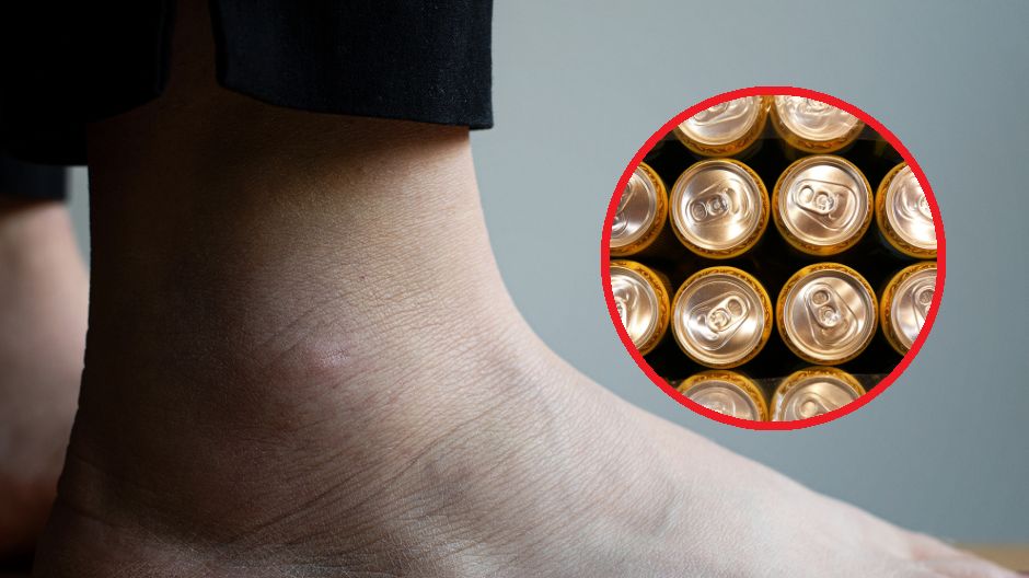 Alkohol wyniszcza wątrobę