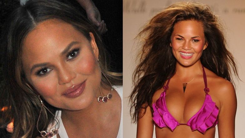 Dramat Chrissy Teigen: Chciała usunąć IMPLANTY PIERSI, ale przeszkodziła jej kwarantanna