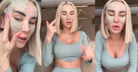 Izabela Macudzińska pokazuje twarz po tureckiej operacji: "Zobaczcie, jak pięknie schodzi żółty kolorek..." (FOTO)
