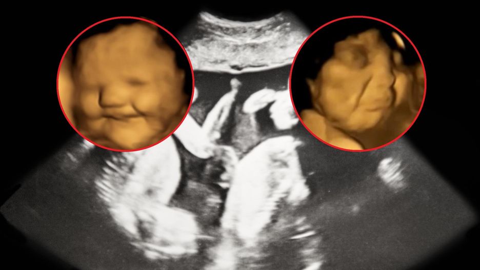 Czy nienarodzone dziecko czuje smak potraw zjadanych przez jego mamę?