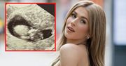 Fani zamarli. Roksana Węgiel opublikowała zdjęcie z USG