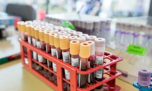 Badacze odkryli nową funkcję komórek wątroby. Chodzi o hemoglobinę