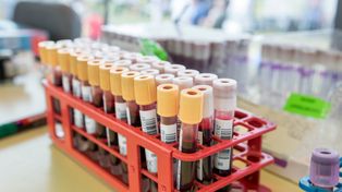 Badacze odkryli nową funkcję komórek wątroby. Chodzi o hemoglobinę