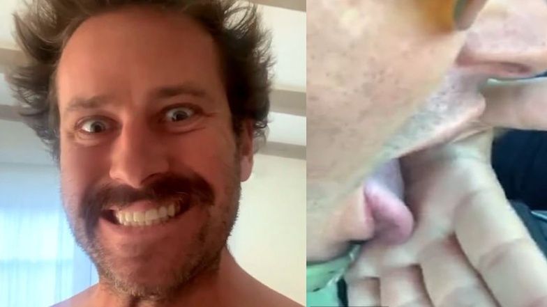 Wyciekły zdjęcia i nagrania z prywatnego konta Armiego Hammera