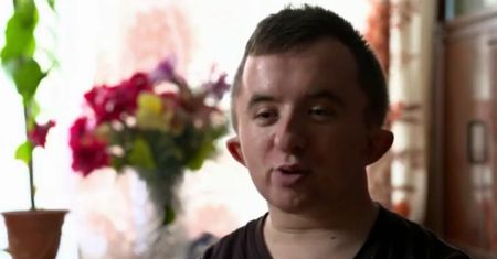 Nie chce, by partnerka się go wstydziła. "Frodo" gorzko o chorobie