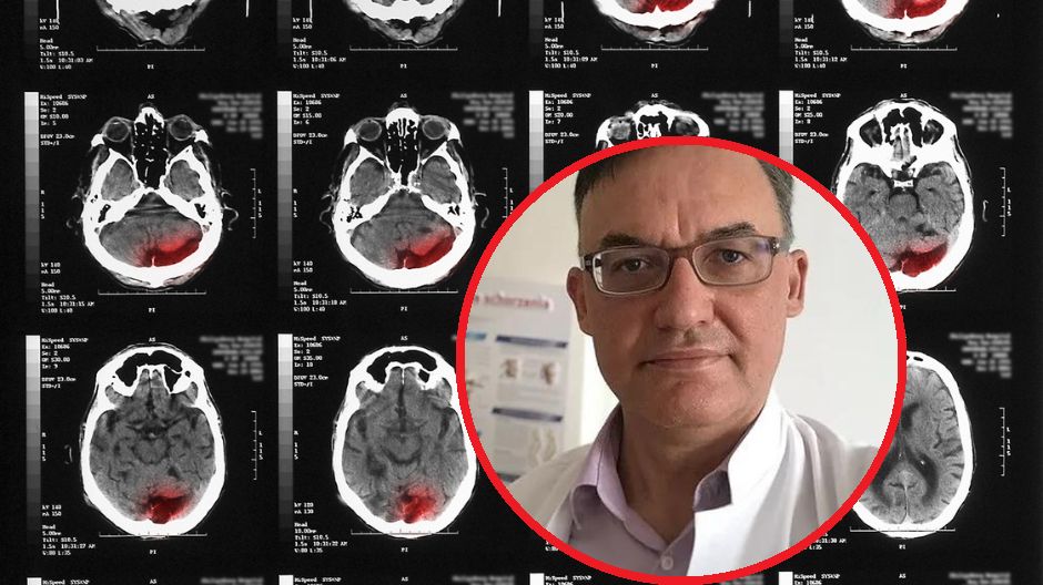 Prof. Rejdak mówi w rozmowie z WP abcZdrowie, jak dbać o mózg