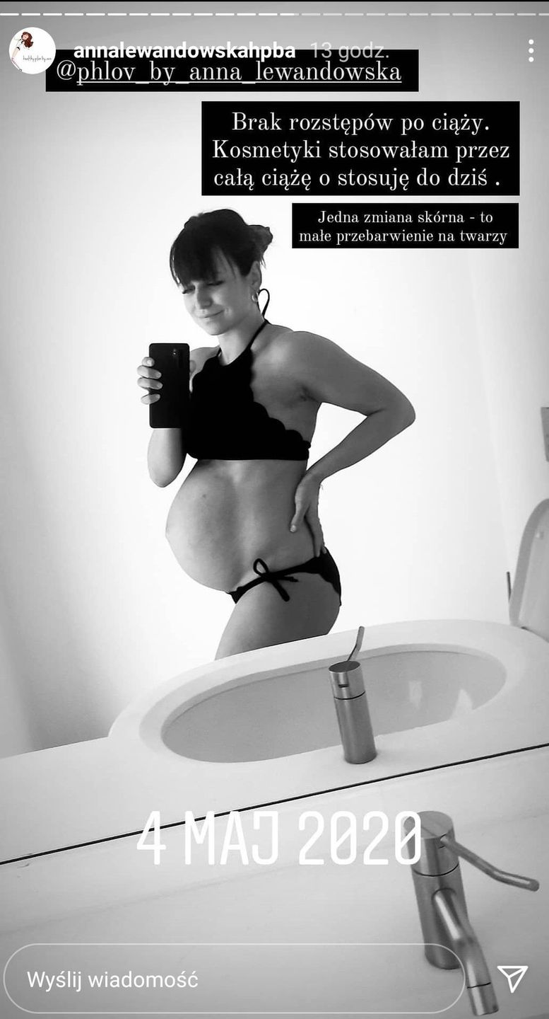 Anna Lewandowska chwali się brakiem rozstępów.