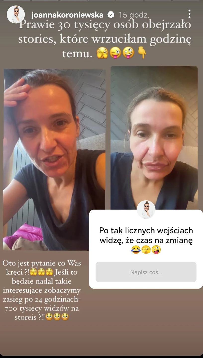 Joanna Koroniewska pokazała monstrualne usta