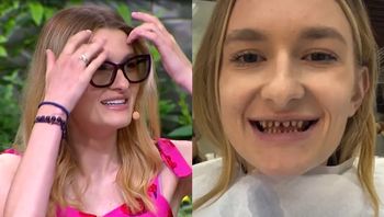 Brutalne pytanie. Dlatego Joanna z "Rolnika" zrobiła zęby w Turcji