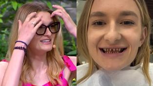 Brutalne pytanie. Dlatego Joanna z "Rolnika" zrobiła zęby w Turcji