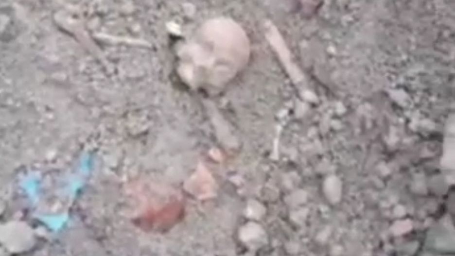 ludzkie szczątki (fot. nadesłane)