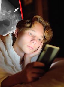 Uzależnił się od smartfona. Straszne, co stało się z jego głową