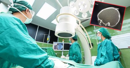 W czaszkę 2-latka wbił się gwóźdź. Wystarczyła chwila nieuwagi podczas zabawy