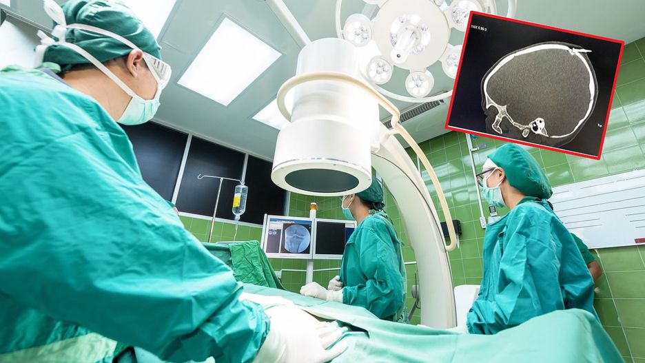 Tragiczny finał niewinnej zabawy. 2-latek trafił do szpitala z gwoździem w głowie