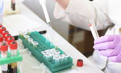 Umierają w dwa dni. Nieznana choroba po zjedzeniu nietoperza