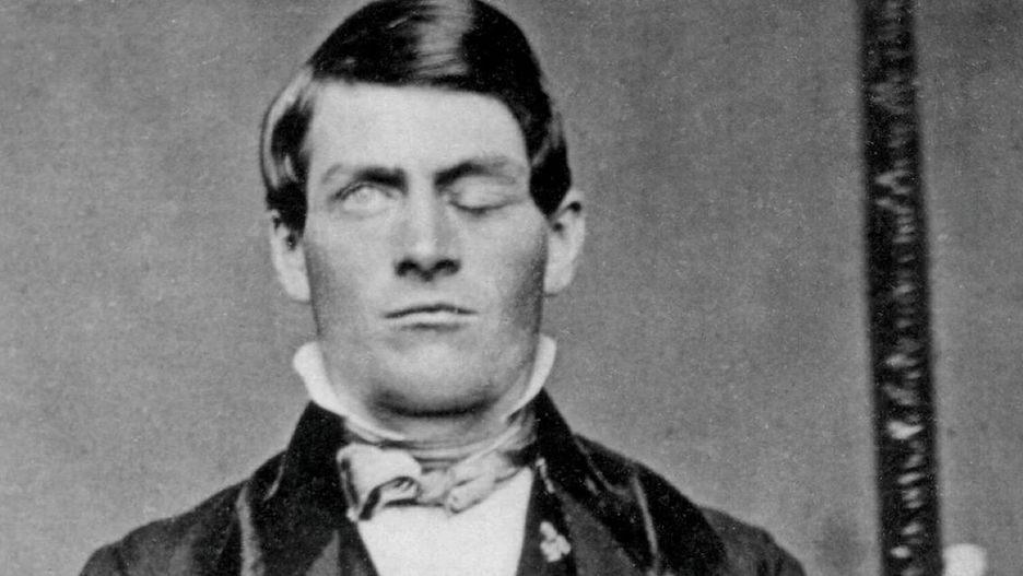 Phineas Gage 