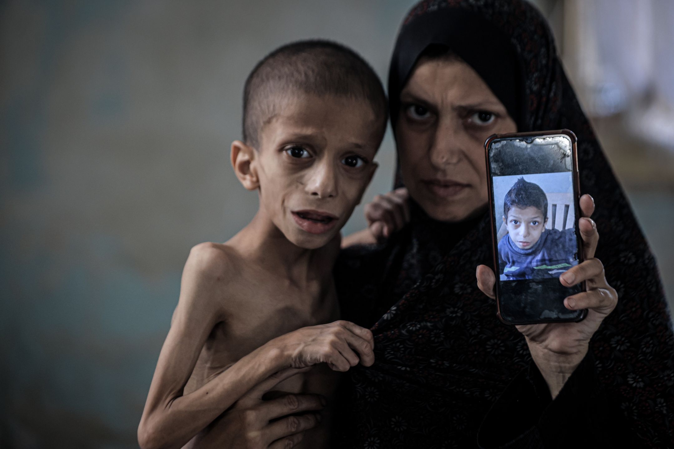 Głód w Strefie Gazy