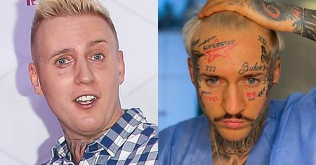 Stifler prezentuje efekty PRZESZCZEPU WŁOSÓW. Internauci oceniają: "Coś ty sobie ZROBIŁ?" (FOTO)