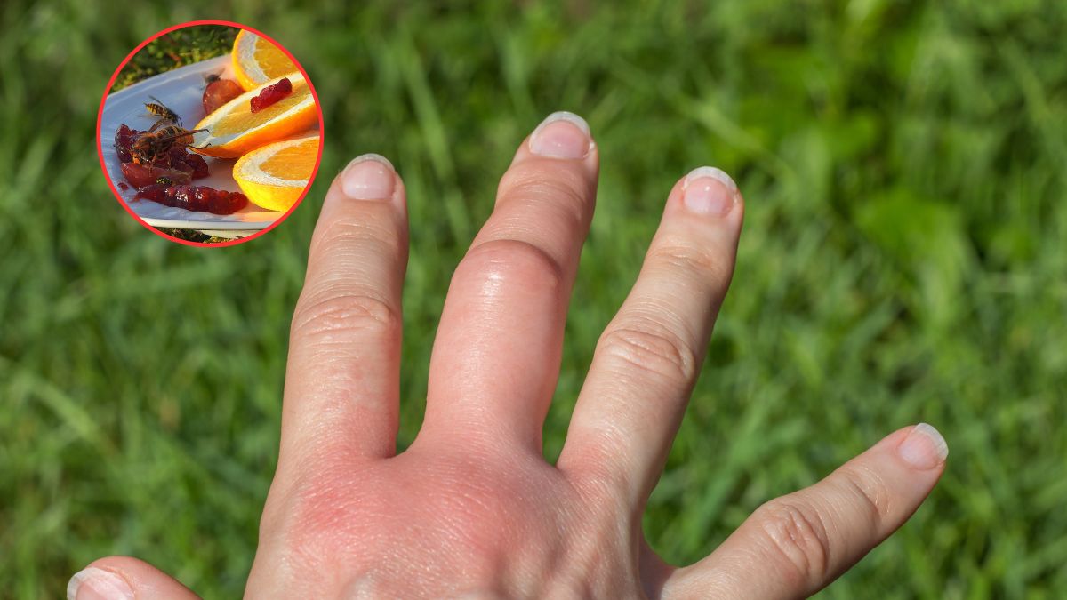 Wstrząs anafilaktyczny po użądleniu stanowi zagrożenie dla życia