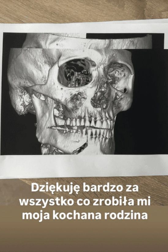 Daniel Martyniuk latem opublikował informację o tym, że został pobity