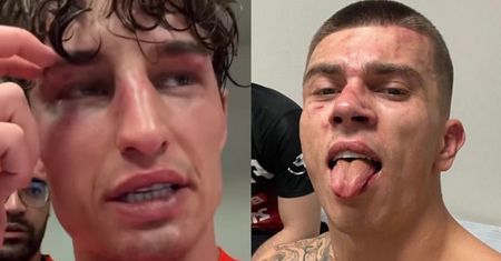 FAME MMA 15. Kacper Błoński WYNIESIONY NA NOSZACH po 18-minutowej walce z Marcinem Dubielem! "Zawsze chciałem takie oko rozcięte"