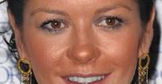 SPALONA twarz Catheriny Zeta-Jones!