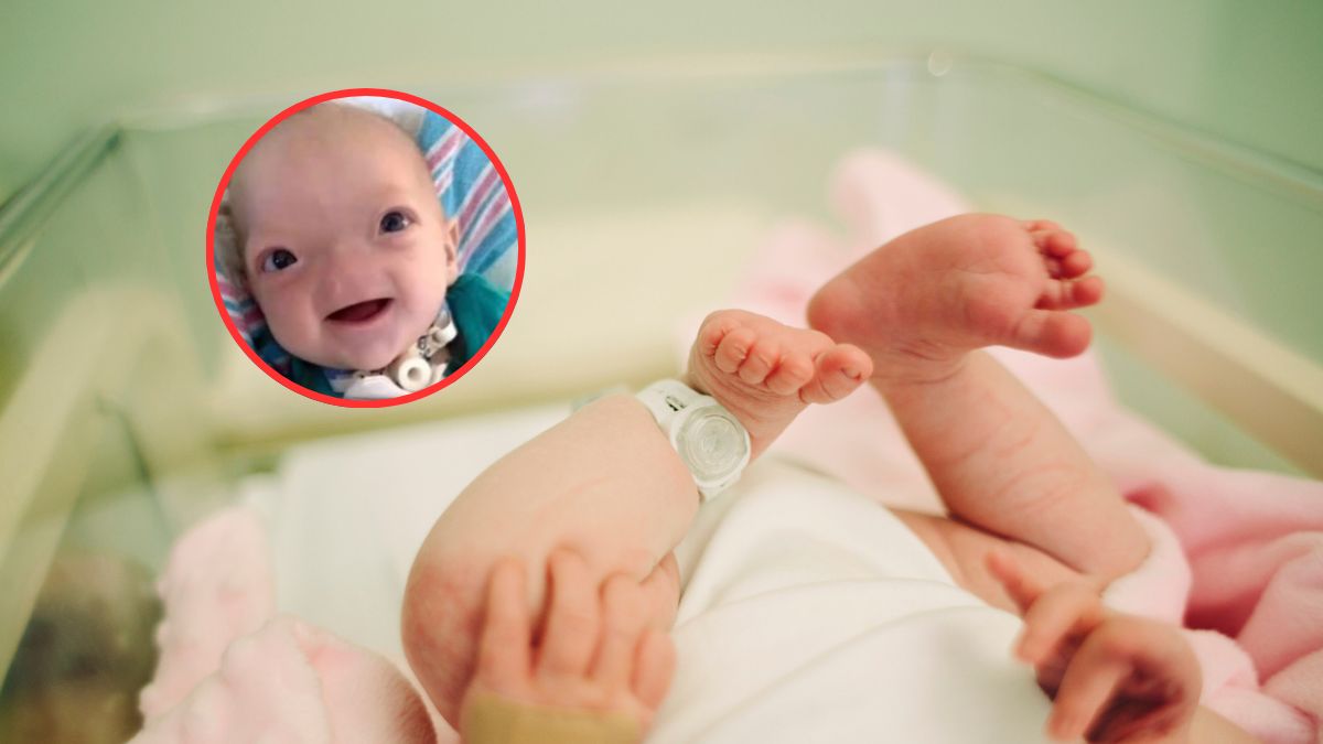 Chłopiec urodził się bez nosa, zdj. Instagram @explainingnews
