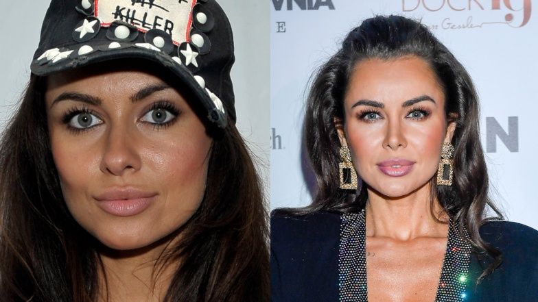 Gwiazdy, które zrobiły sobie nos