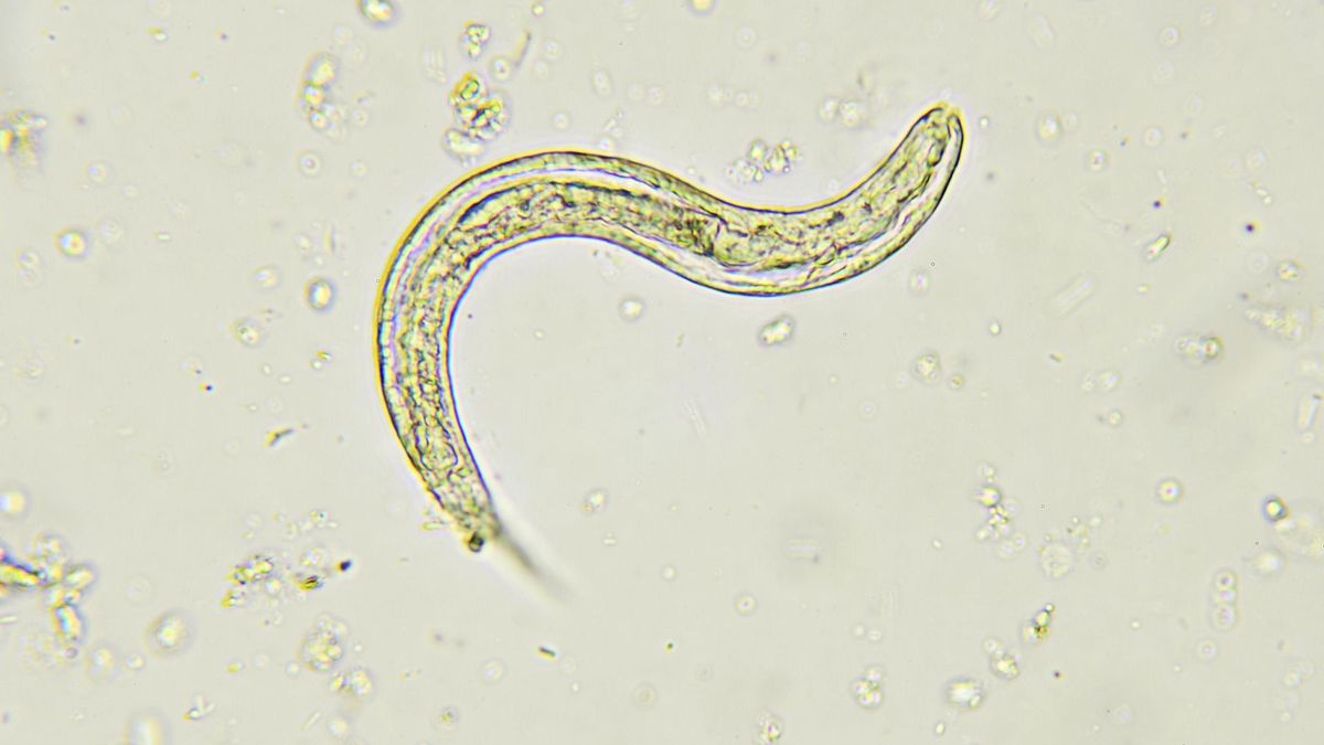 Owsica jest coraz powszechniejsza