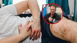 Miał klasyczne objawy raka jelit. Kolonoskopia ujawniła guz wielkości 10 cm