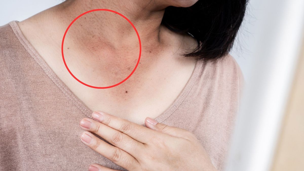 Problem dotyczy wielu kobiet