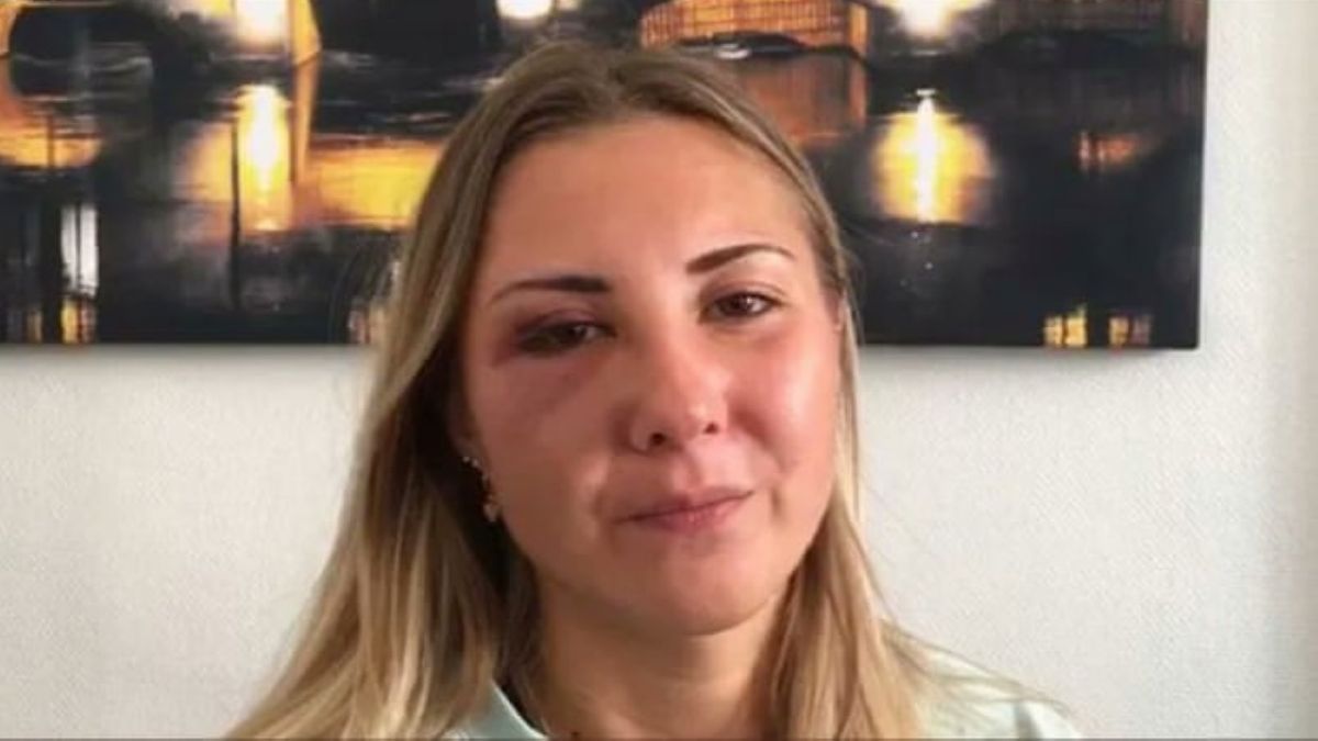 22-letnia Francuzka została zaatakowana z powodu noszenia spódnicy