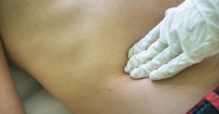 Co roku zabija 12 tys. Polaków. Naukowcy potwierdzili przyczynę groźnego nowotworu