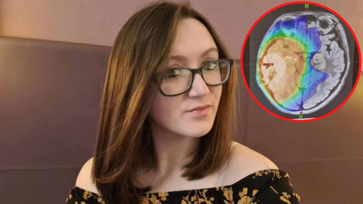 Badanie MRI wykazało łagodny nowotwór mózgu