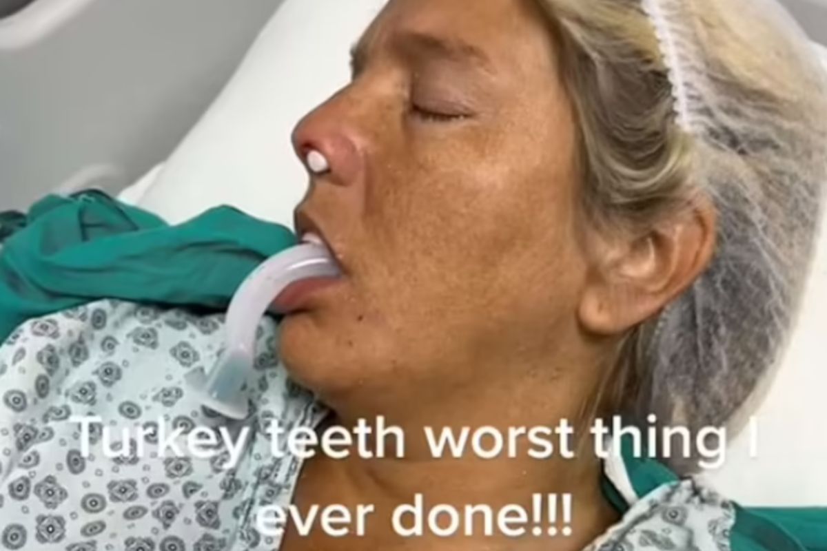 Do Turcji udała się na popularny zabieg. Jest zdruzgotana efektem: "Jakby ktoś postrzelił mnie w usta"