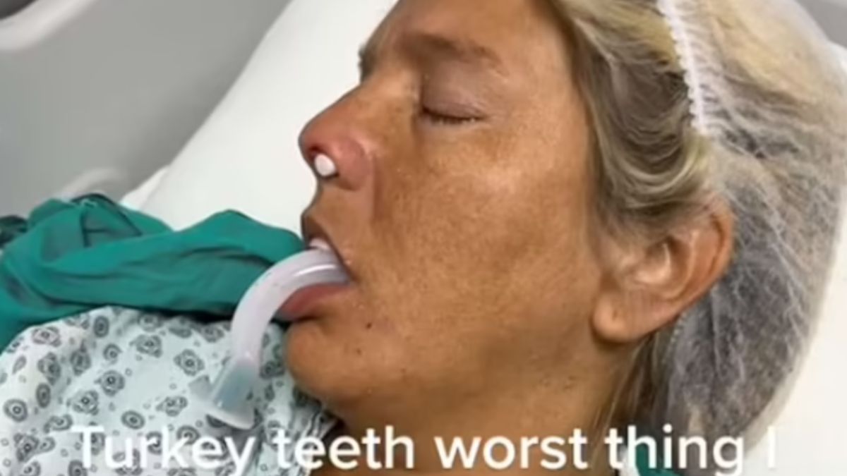 Zamiast hollywoodzkiego uśmiechu po podróży z Turcji pozostała jej trauma