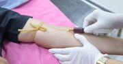 Koronawirus: grupa krwi może dać przewagę w walce z COVID-19. Nowe badania