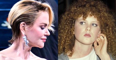 Nicole Kidman ma za sobą NIEUDANY lifting? Chirurg zwrócił uwagę na efekt "elfich uszu"...