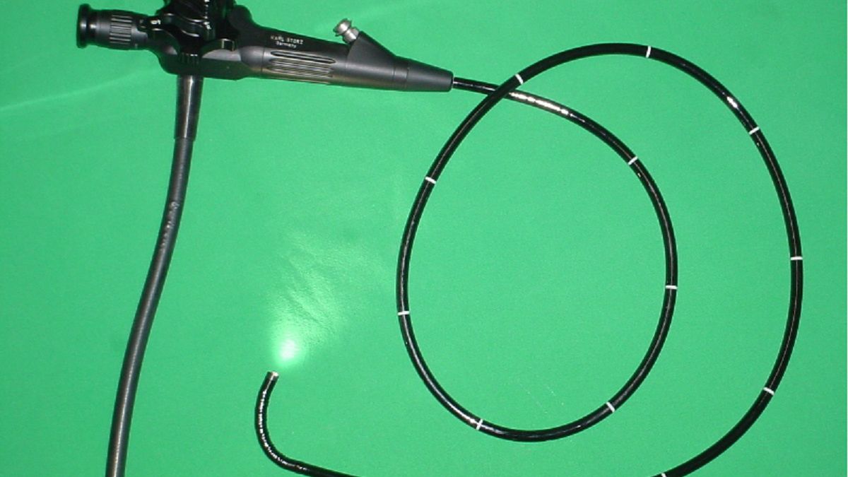 Jak działa endoskop? Wszystko, co warto wiedzieć przed zakupem 1