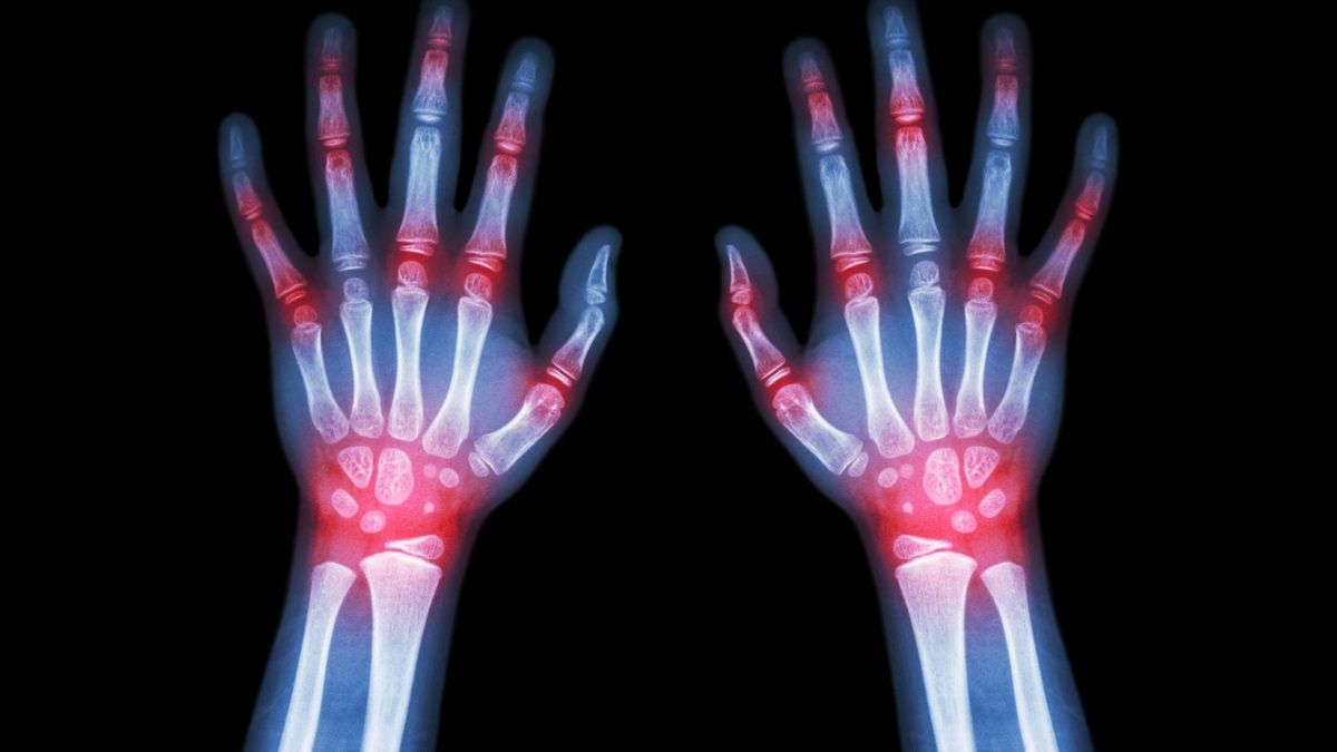 W zimie wiele dolegliwości nasila się. Wiąże się to często z warunkami pogodowymi. Jakie to choroby?