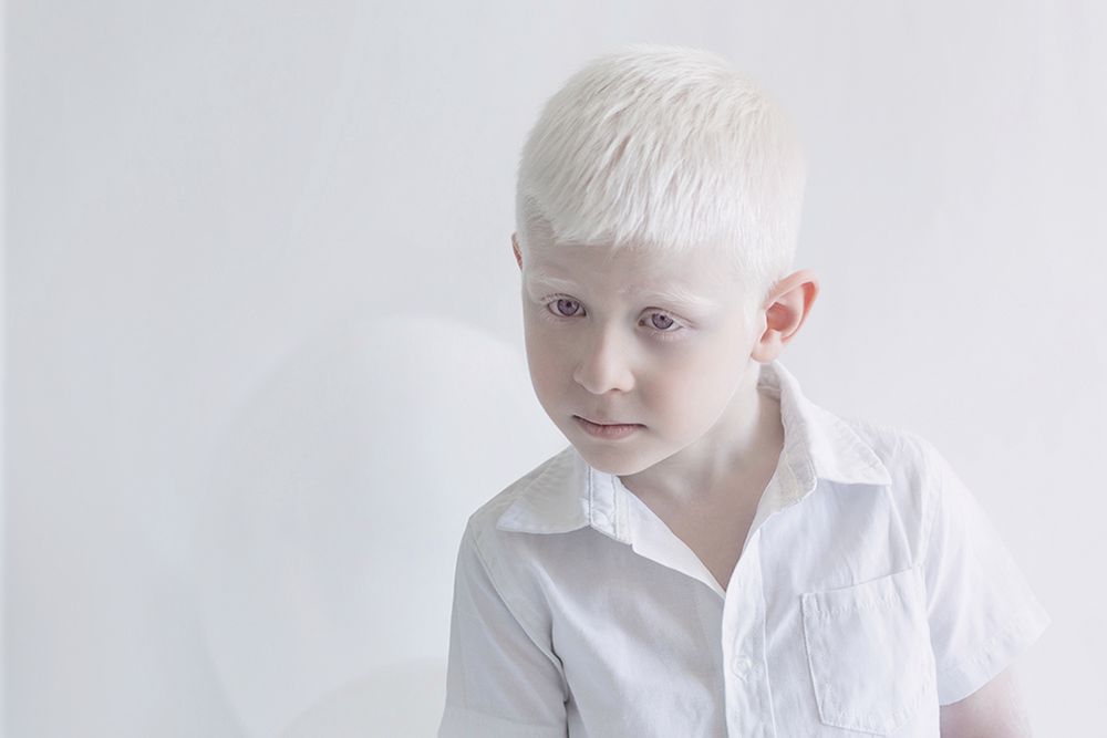 Julia Taits ujęła piękno alabastrowej cery ludzi z albinizmem w baśniowym projekcie 8