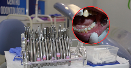 Pacjent spotka się z odmową. Od 1 stycznia zmiany w gabinecie dentysty