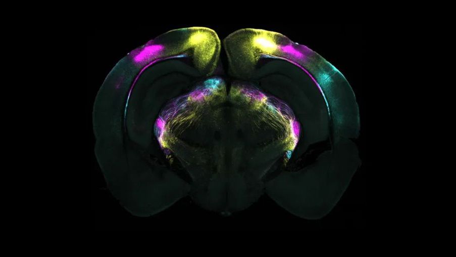 Na zdjęciu mózg myszy z uwidocznionymi obszarami zidentyfikowany