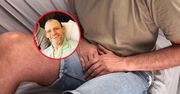 45-latek stracił pół penisa. Wszystko przez złą diagnozę
