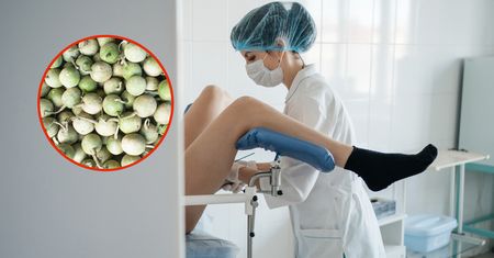 Ginekolog przeżył szok podczas badania. Ciało obce było od 20 lat