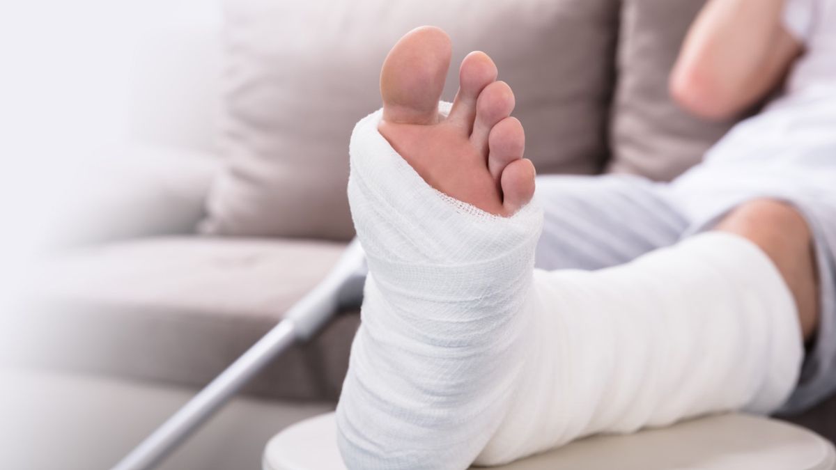 Mechanizm złamania kości