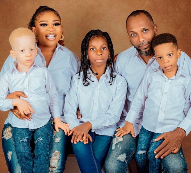 Urodziły im się nietypowe bliźnięta